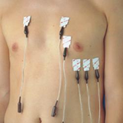 1000 Electrodes ECG de diagnostics Rectangulaires