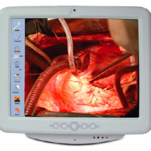 Enregistreur Videos, Images et Ecran Tactile 17