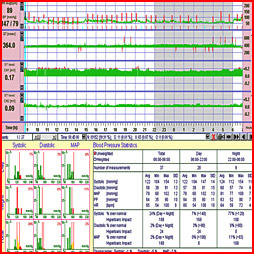 Holter ECG + Tensionnel 2 en 1 + Logiciel PC