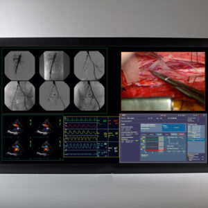 Moniteur Chirurgical 56 Quad Full HD