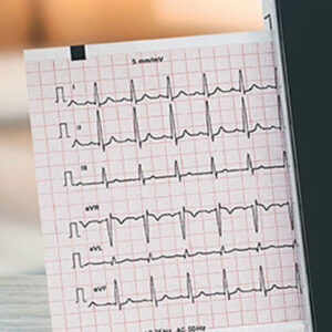 Pliage pour ECG FT-1